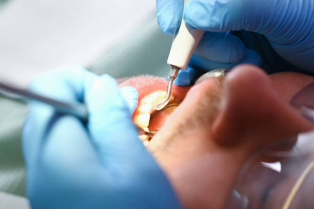 Best Emergency Treatment for Oral Infections in Christmas, FL